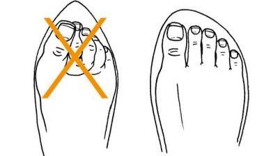 Desenho de dois calçados, o primeiro com um calcçado de pico fino, no qual mostra o pé apertado na ponta, se sobreponto entre si, demosntrando que é errado o uso desse calçado. A segunda imagem, de um calçado com a ponta arredondada, com os dedos livres, sem causar sobreposição dos membros.