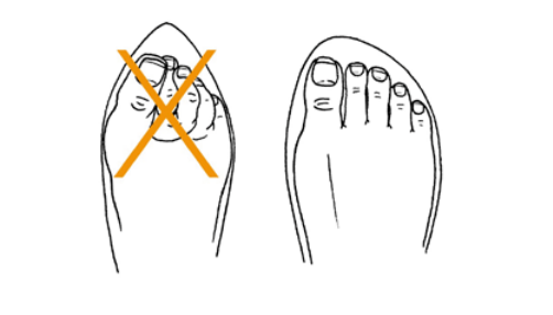 Desenho de dois calçados. O primeiro com a ponta estreita, que deixa os dedos sobrepostos, que não é o recomendado. O segundo mostra uma sapato com a ponta arredondada, que permite que os dedos fiquem confortáveis e sem aperto dentro do sapato. 