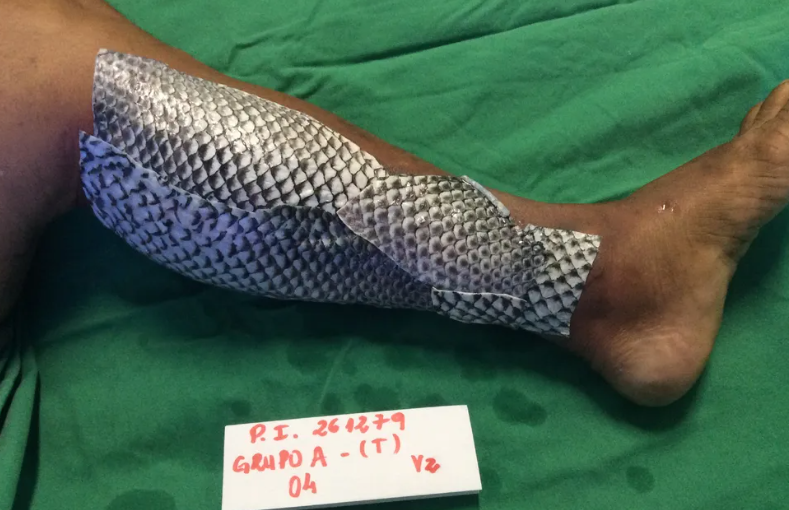 Foto de uma perna, com a pele de tilápia acima da queimadura. Está sob um fundo cor verde o membro.