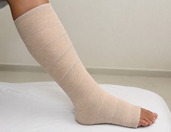 Perna com bandagem compressiva de múltiplas camadas aplicada do pé até abaixo do joelho, com as faixas sobrepostas em espiral e deixando os dedos dos pés expostos.
